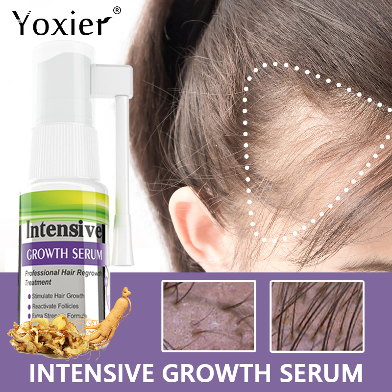 Hair Care For Hair Growth - 集中成長血清,脱毛防止,頭皮治療,再活性化,栄養補給,生姜ケア