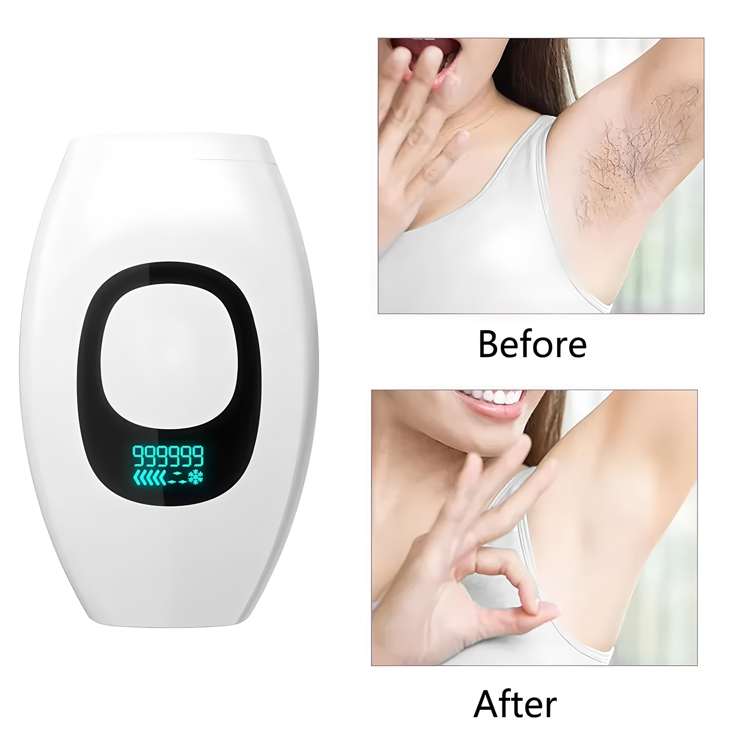 From Home Hair Care - 美容ケア IPL 脱毛装置 990000 フラッシュ 無痛永久脱毛