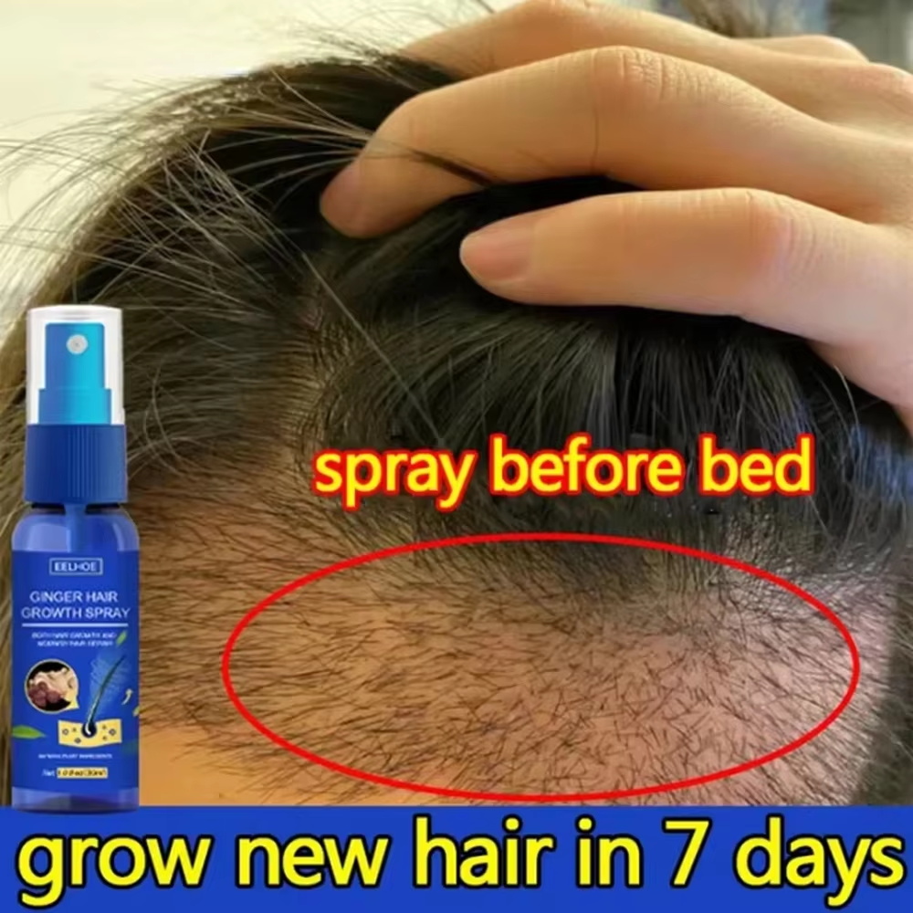 Hair Care For Hair Growth - 速効性ジンジャーヘアグローススプレー、毛根育成、脱毛防止、育毛セラム、頭皮ダメージ修復、栄養ケア製品、女性男性用