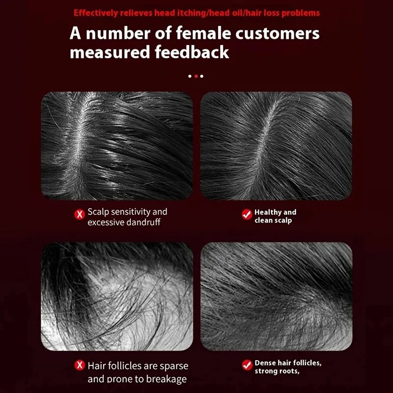 電動振動マッサージコームヘアケアブラシ頭皮オイルアプリケータ - Hair Care For Hair Growth のレビューと価格