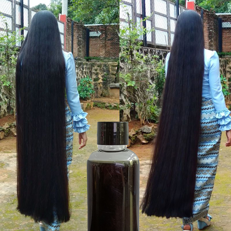 髪の成長のための中国の治療,50ml,手で振る,純粋な野菜の - Hair Care Vegetables のレビューと価格