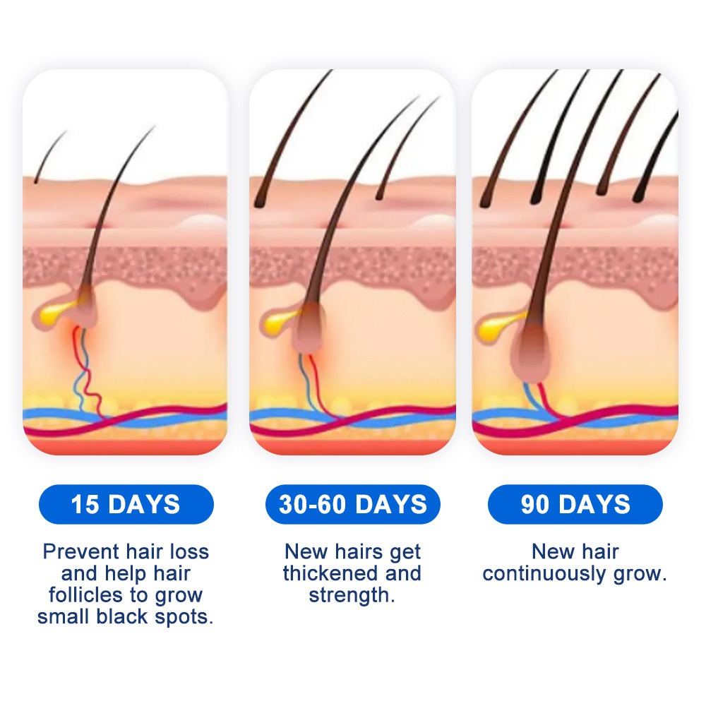脱毛症育毛スプレー ソフォラ フラベセンス 脱毛症クリームス - Hair Care For Hair Growth のレビューと価格