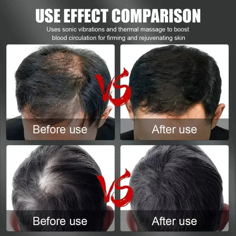 660nm 850nm赤色光赤外線ヘアセラピー育毛キャップ脱 - Hair Care For Hair Growth のレビューと価格